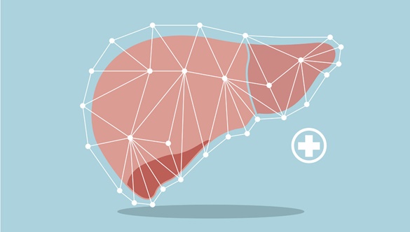 Hemochromatoza – gdy wątroba nie radzi sobie z nadmiarem żelaza