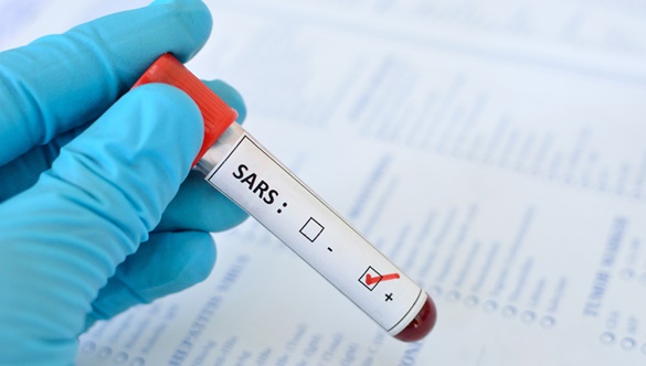 Czy wiesz co to jest SARS i jakie są jego objawy?