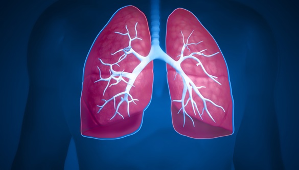 Czym grozi sarkoidoza płuc?